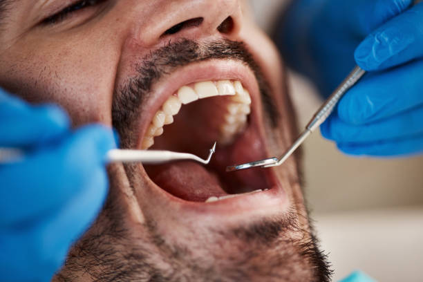 Full Mouth Reconstruction in Niles, OH